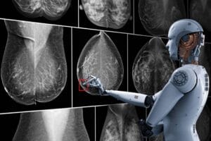 AI Mammographie 1 e1638532134177 1