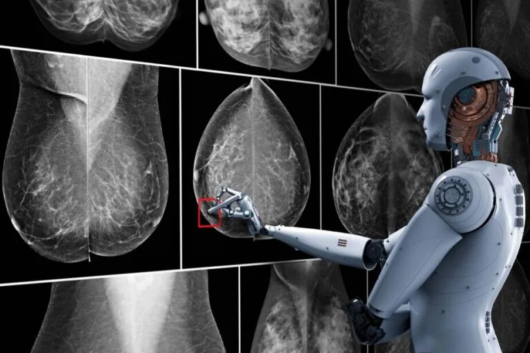 AI Mammographie 1 e1638532134177 1
